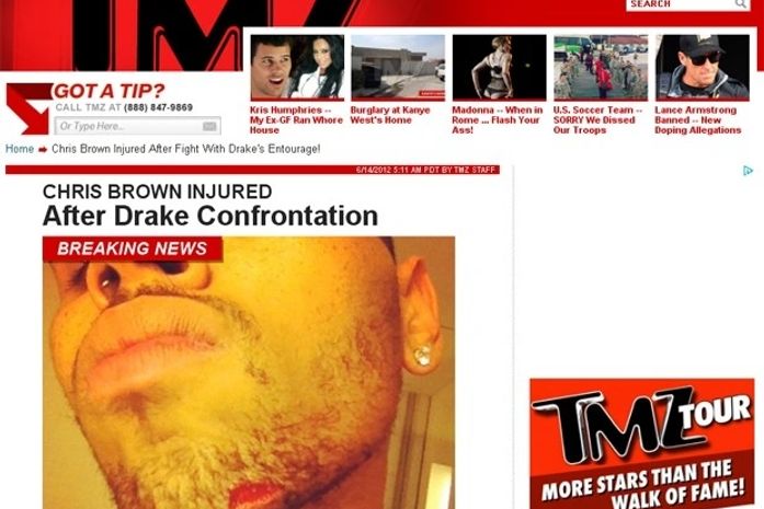 Chris Brown fere o queixo em briga com ex-affair de Rihanna, diz site