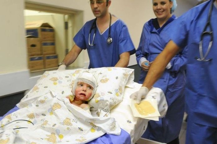 Menina recebe pele clonada