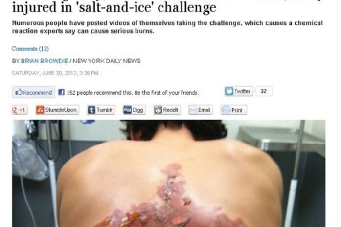 Garoto queimou as costas com gelo e sal