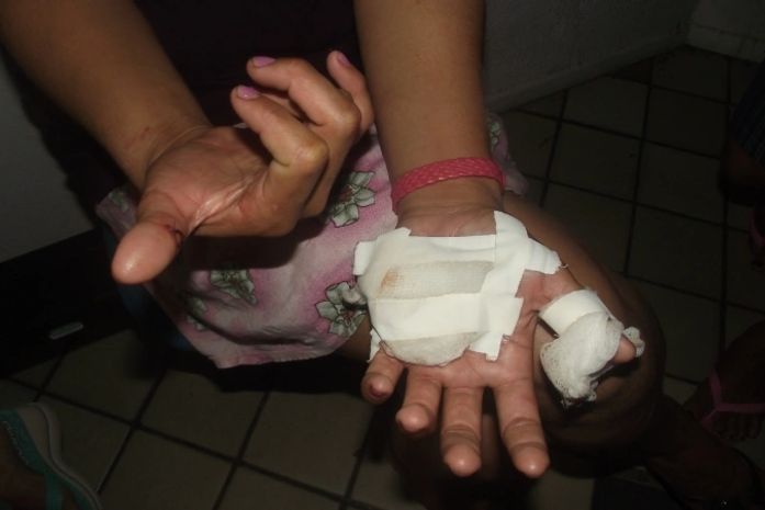 Vítima de ataque no Jacintinho