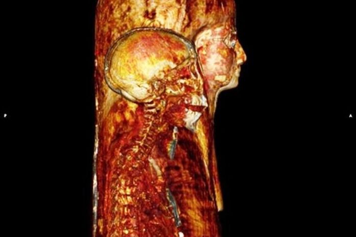 Múmias egípcias de museu do Reino Unido são escaneadas por cientistas