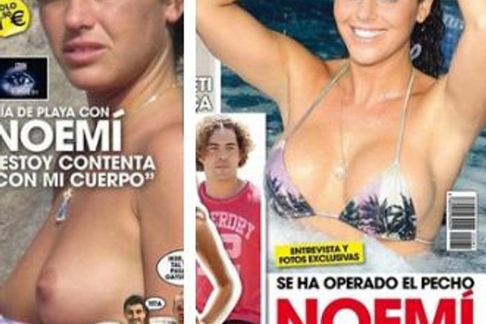 Noemí, do 'Gran Hermano', coloca silicone nos seios. Veja antes e depois