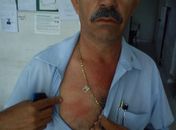 Cabo Chico denuncia violência 