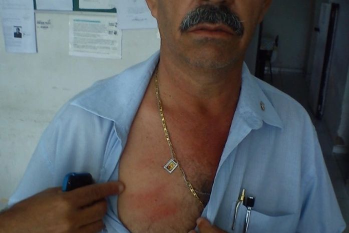 Cabo Chico denuncia violência