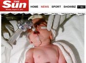 Bebê que nasceu com coração invertido surpreende médicos