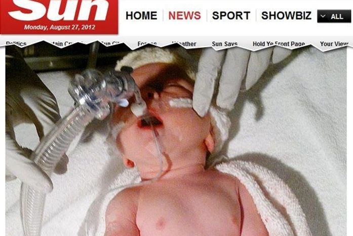 Bebê que nasceu com coração invertido surpreende médicos