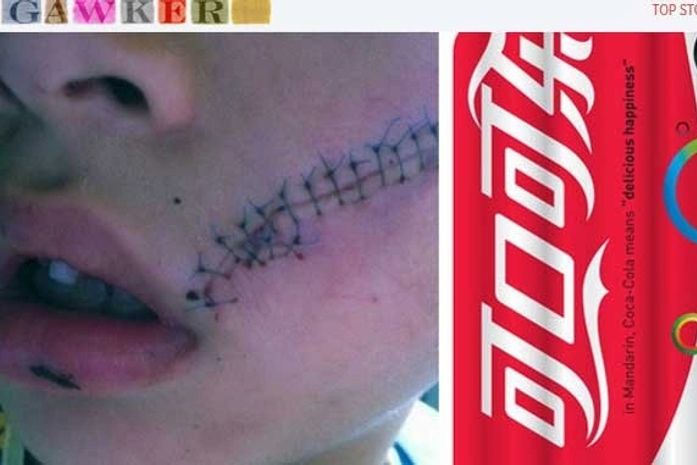 Chinês leva 31 pontos no rosto após refrigerante explodir e posta foto