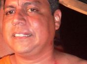Renildo Aquino funcionário da Prefeitura com sua camisa rasgada e arranhões pelo corpo