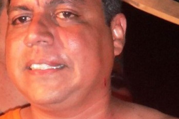 Renildo Aquino funcionário da Prefeitura com sua camisa rasgada e arranhões pelo corpo