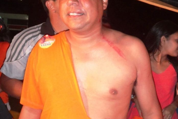 Renildo Aquino funcionário da Prefeitura com sua camisa rasgada e arranhões pelo corpo