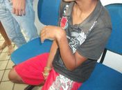 Mãe bebe e quebra punho do filho de treze anos