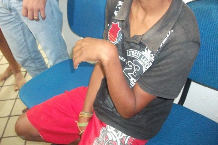 Mãe bebe e quebra punho do filho de treze anos