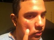 Cinegrafista foi agredido e prestou queixa