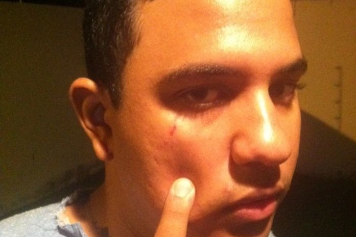 Cinegrafista foi agredido e prestou queixa