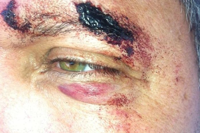 Candidato a prefeito sofre agressão e formaliza denúncia