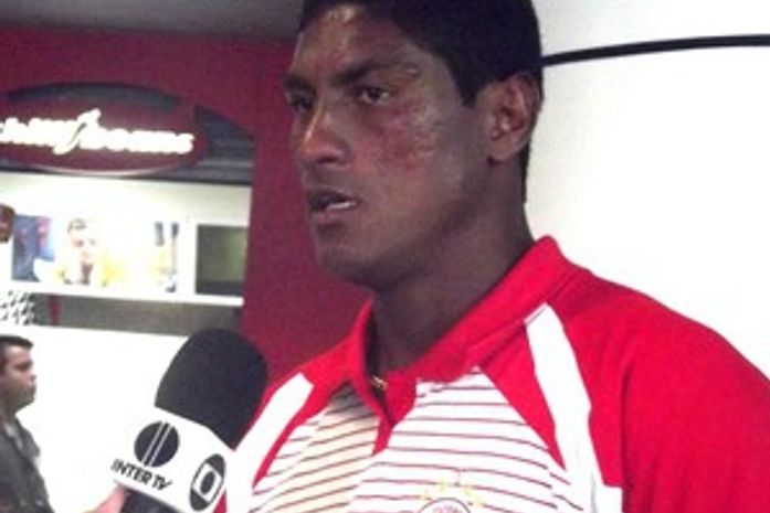 América-RN confirma rescisão de contrato de atleta pego no doping