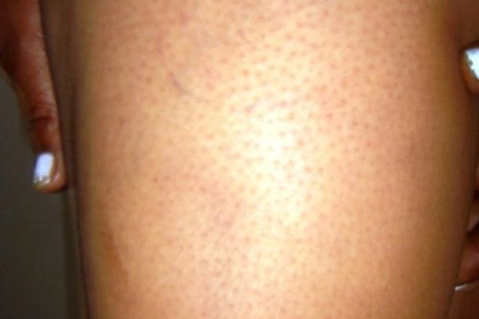 Irmão de prefeito é acusado de espancar mulher com socos e pontapés