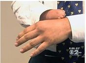 Lutador sem mão faz estreia profissional no boxe