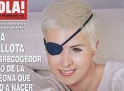 Piloto espanhola que perdeu olho direito em acidente comemora recuperação