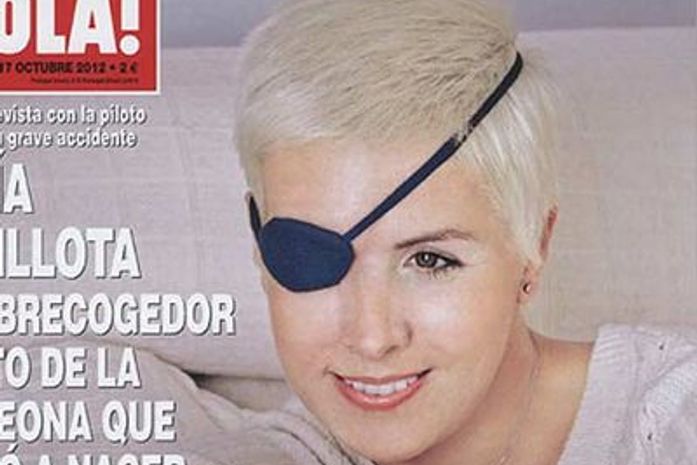 Piloto espanhola que perdeu olho direito em acidente comemora recuperação