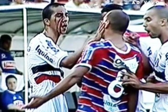 Jogador esfrega sangue no rosto em clássico na Série C