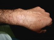 Sindpol cobra providência ao abuso de autoridade da FN