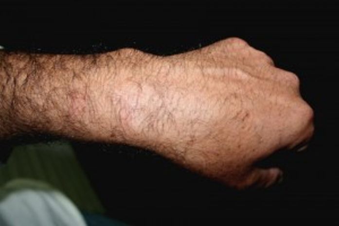 Sindpol cobra providência ao abuso de autoridade da FN