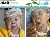 Chinesa de 1 ano sofre de doença rara de pele que a faz parecer idosa