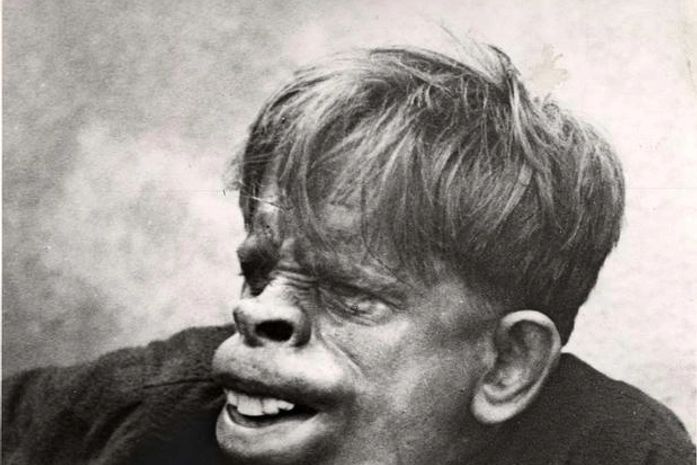 Foto antiga com 'homem-macaco do Brasil' faz sucesso na web