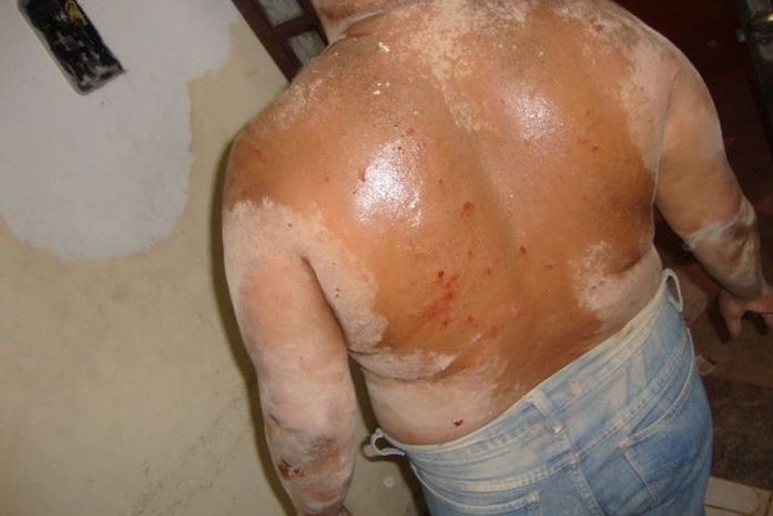 Morador próximo ao local da explosão