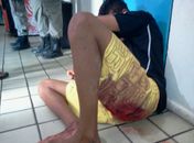 Menor ficou ferido na perna 