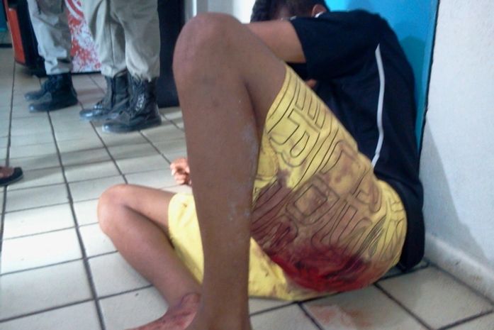 Menor ficou ferido na perna