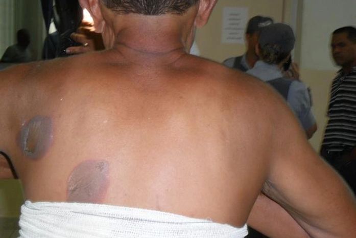 Ladrões torturam deficiente para roubar dinheiro de imóvel