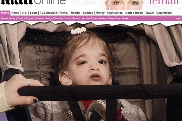 EUA: caso de menina que não envelhece desafia médicos há anos