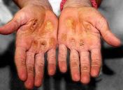 Jade Barbosa posta foto chocante e desabafa na internet