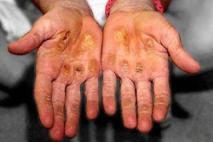 Jade Barbosa posta foto chocante e desabafa na internet