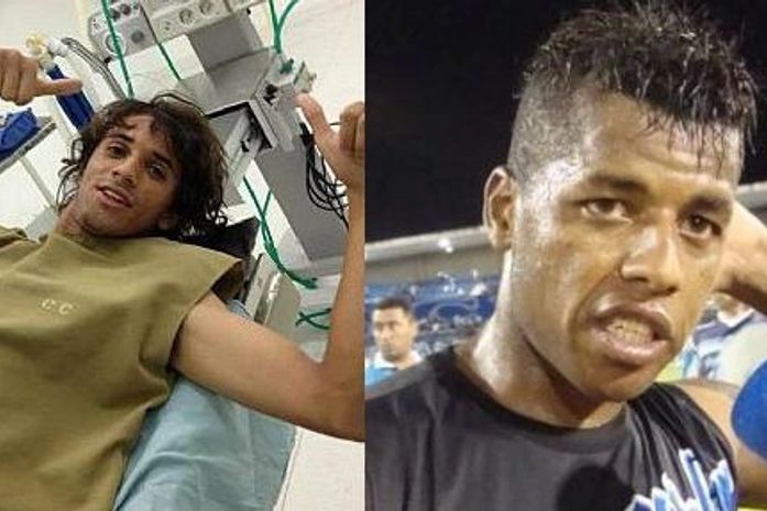 Fim de semana do ASA tem fratura de Valdívia e susto de Audálio