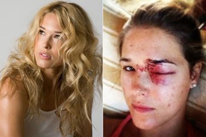 Musa do vôlei que levou 50 pontos perde bebê