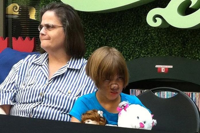 De rosto novo, menina atacada por guaxinim volta à escola