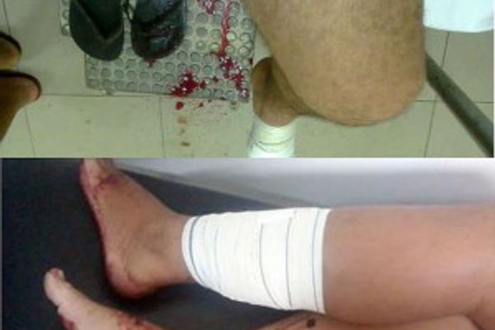 Três são baleados durante bloco em São Miguel