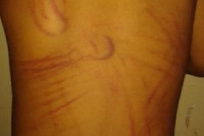 Mãe chicoteia filha de 2 anos por queimar nota de R$ 5