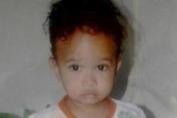 Alan, de 2 anos de idade, que teve uma das pernas decepada