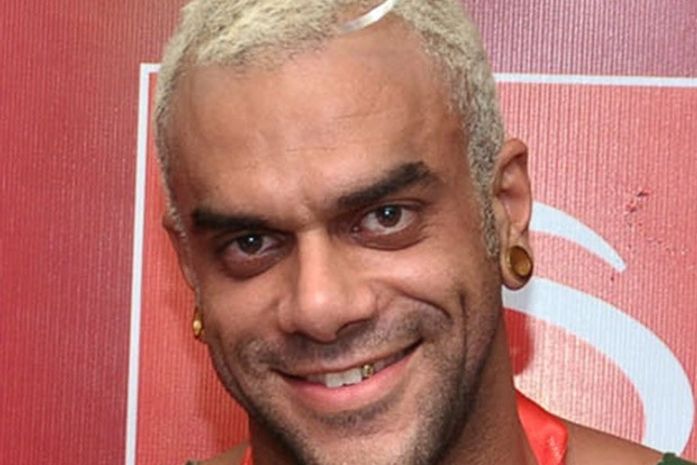 Ex-BBB Alan Passos usa dente de ouro: 'Coloco de vez em quando'