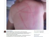 Mãe alega que vidro em sabonete infantil machucou seu filho