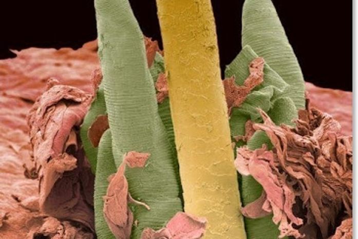 Você não vai gostar de saber o que está vendo nesta foto