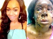 Polícia prende dois acusados de ataque com ácido no Reino Unido