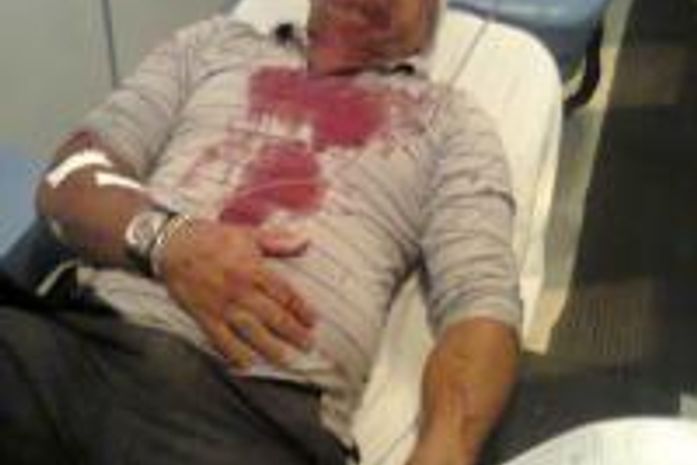 Vigilante é agredido a pauladas