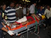 Professor de dança é atropelado e tem perna fraturada na Fernandes Lima