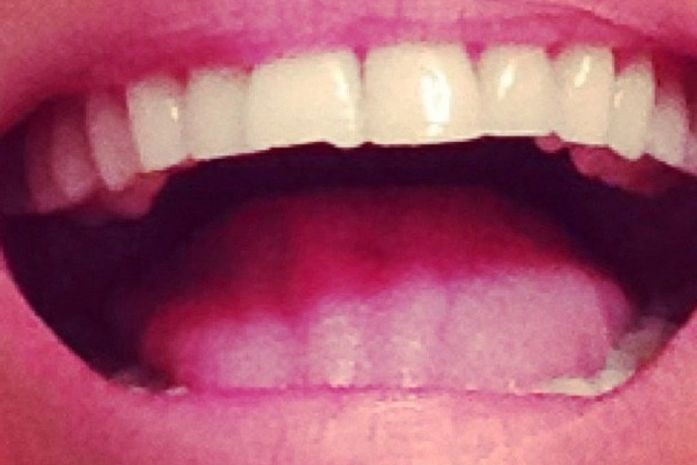 Ellen Jabour quebra o dente e posta foto: 'Quebrou um pedação'