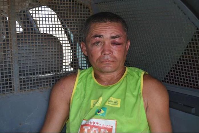 Severino José foi espancado pela população